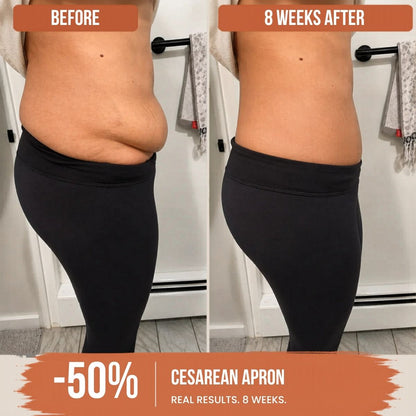 High-waisted shaping panty specifically for postpartum use