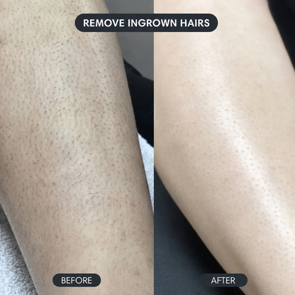 Solniera—Body Hair Removal Spray