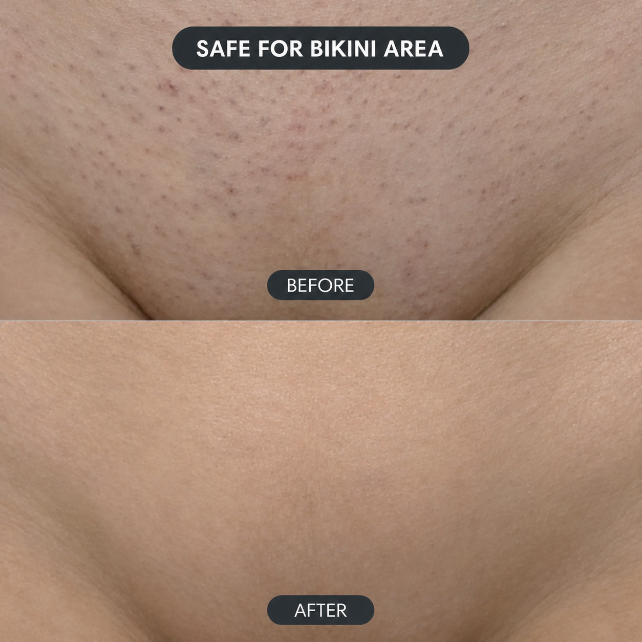 Solniera—Body Hair Removal Spray